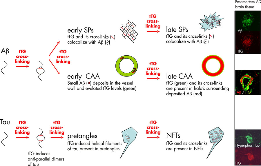 tTG in alzheimers disease